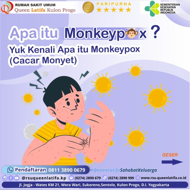 Edukasi MonkeyPox ( Cacar Monyet )